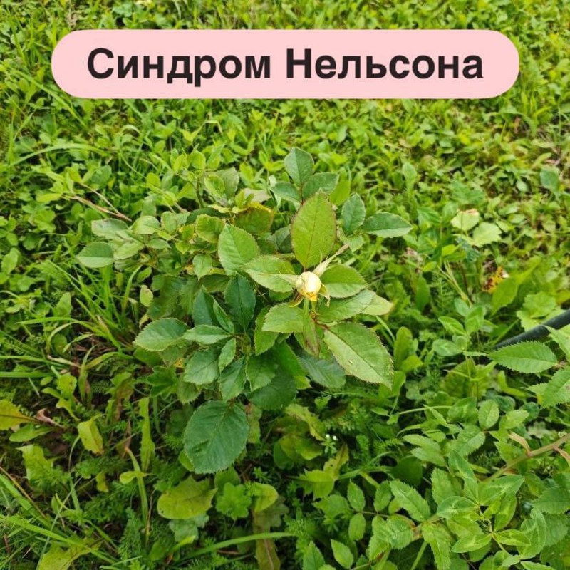 Иллюстрация к публикации «Синдром Нельсона», 1